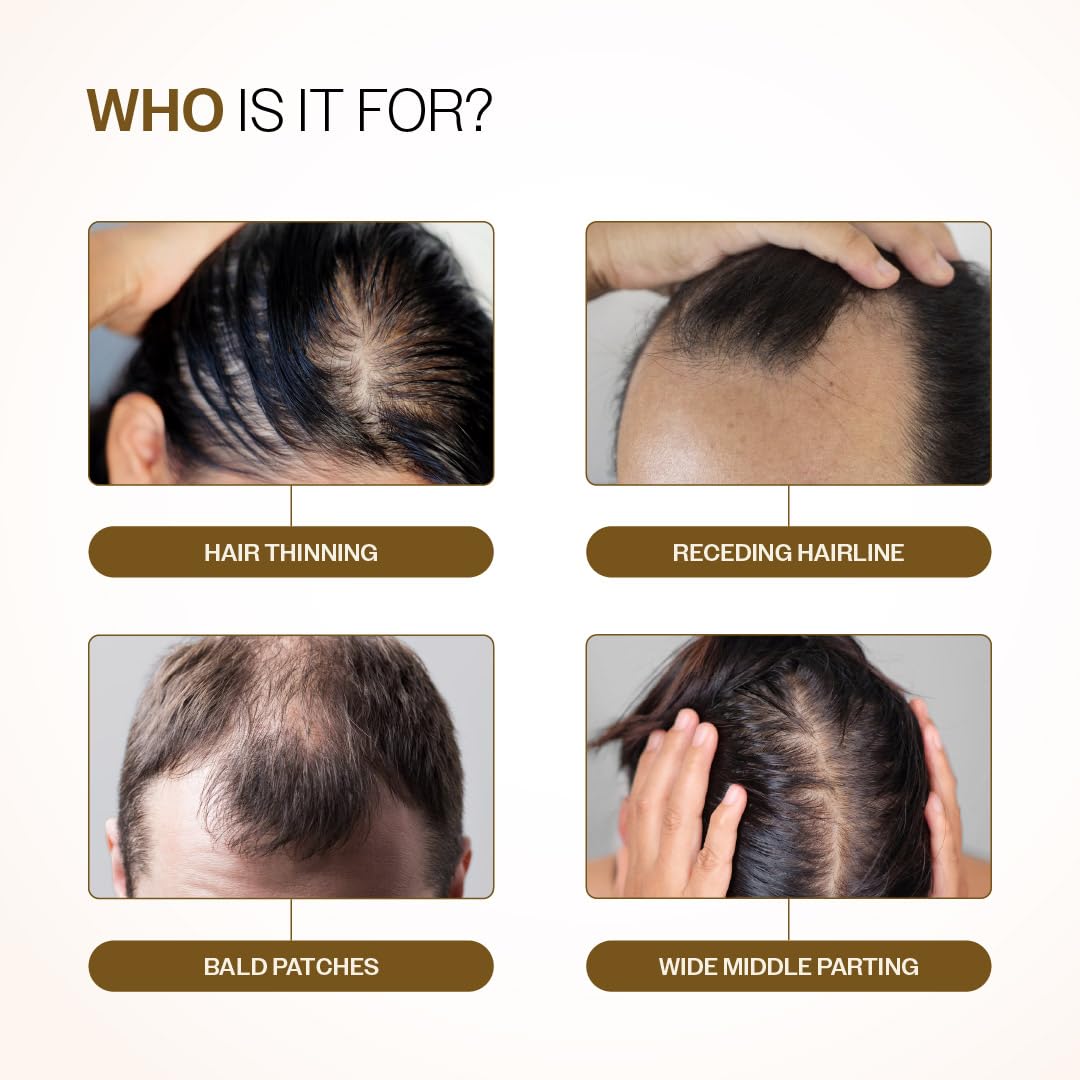 Bare Anatomy एडवांस हेयर ग्रोथ सीरम रोल-ऑन| 3% Redensyl + 4% Anagain + 2% Baicapil + 5% रोज़मेरी, राइस वॉटर, बायोटिन और सॉ पामेटो | बालों के झड़ने को  image 3