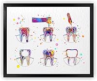 Vista 1 de Dignovel Studios Póster de impresión artística de acuarela de 8 x 10 sin marco, tratamiento de endodoncia, clínica dental, decoración de dentista
