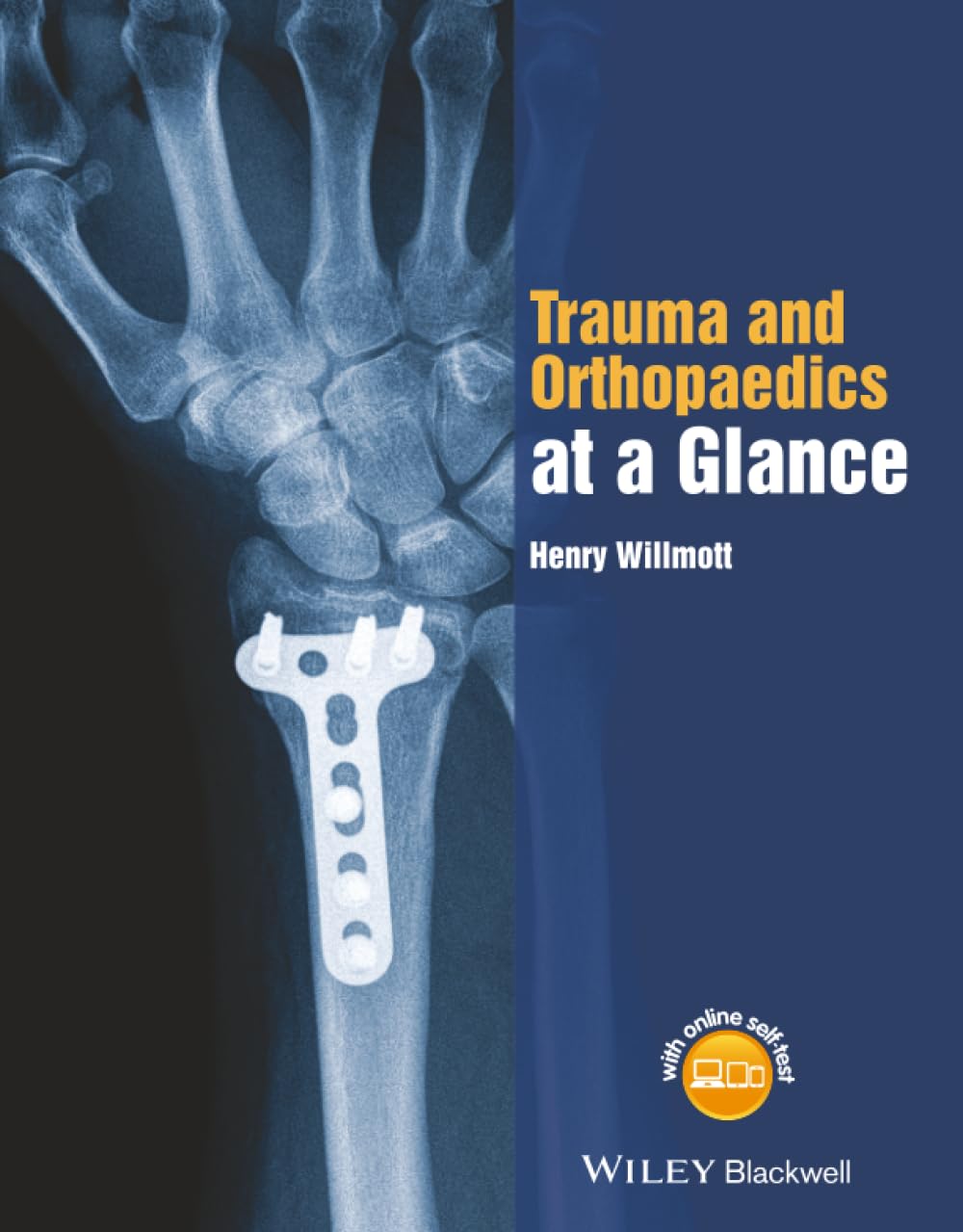 Trauma and Orthopaedics at a Glance by H Willmott PAPERBACK 9781118802533