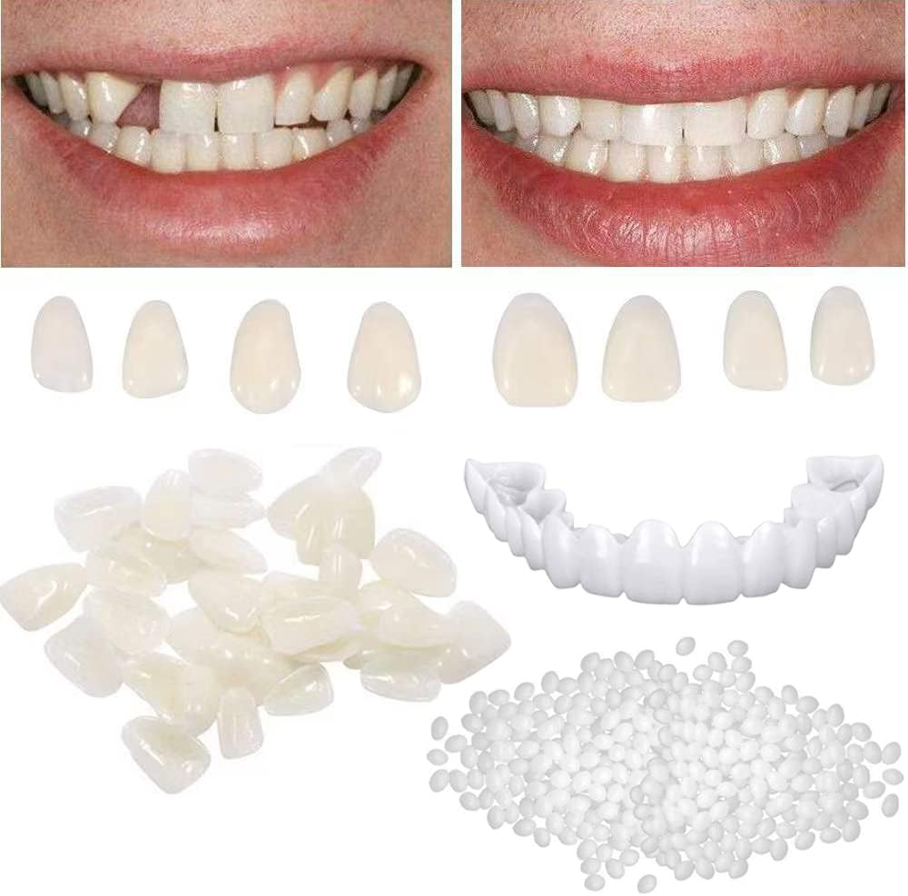 Tooth Repair Kit for Fixing the Missing Chipped and Broken Tooth Gap Temporary Replacement Thermal Beads