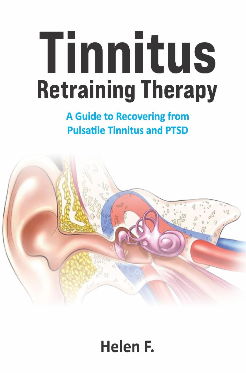 Tinnitus Retraining Therapy: A Guide to Recovering from Pulsatile Tinnitus and PTSD