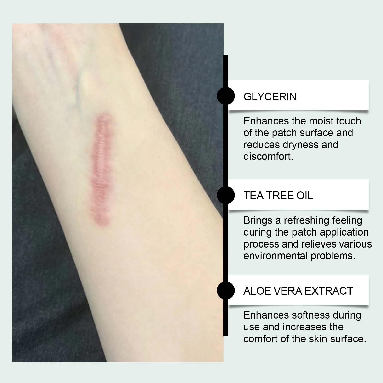 Foglie di cicatrice in silicone medico per la cura della pelle di bellezza tagliabili, con collagene, impermeabili fogli medici per taglio cesareo e cheloidi, traspiranti, Imper