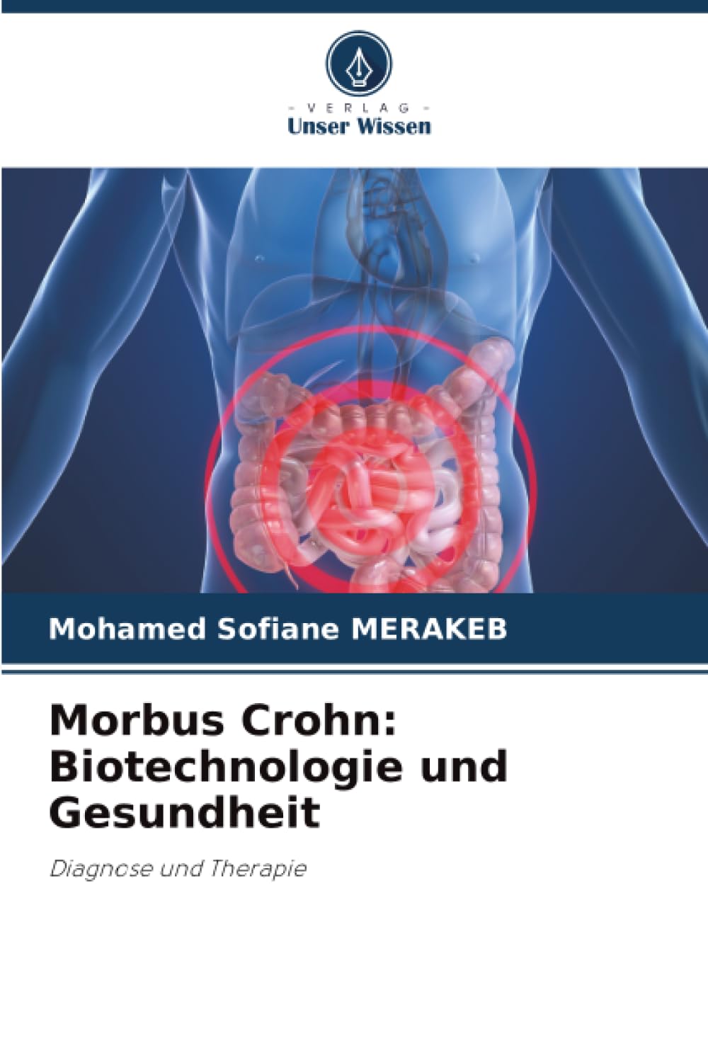 Morbus Crohn: Biotechnologie und Gesundheit: Diagnose und Therapie