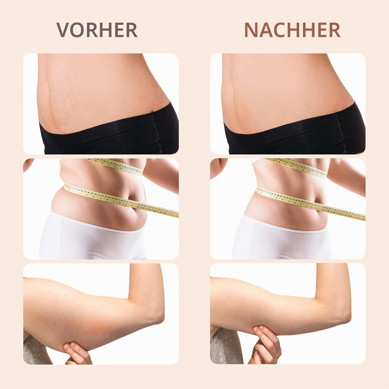 Cellulite Massagegerät, Anti Lipödem Handmassagegerät, Massage Anti Cellulite Mit 3 Modi, VerfüGt über 6 MassageköPfe mit GrößEren Bereichen für Bauch, Taille, Arme, Beine, Gesäß und Rückenmassagefe