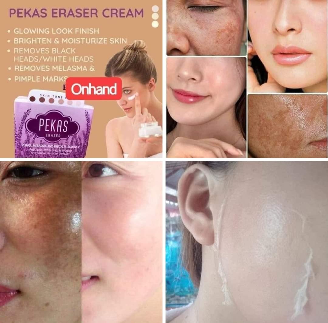 Capadosa Day & Night Cream / Pekas Eraser Cream 10g Combo by ...