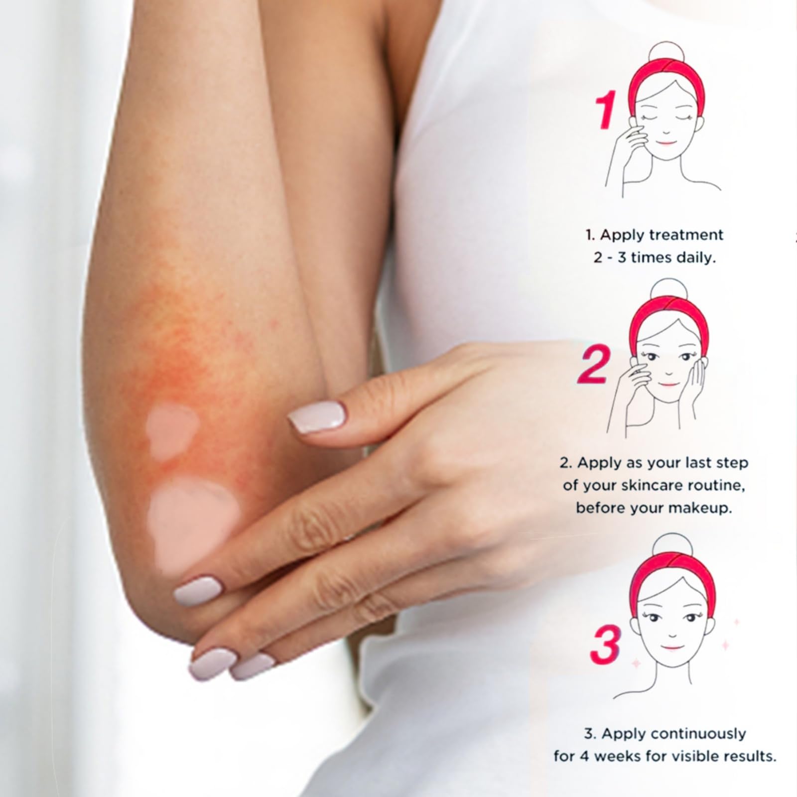 NOVOLAN Eczema Relief Cream, 100g Healing Skin Care Cream for Eczema, Relieves Itching, Dryness, Scaling, Soothes Irritated Skin, Ideal for Foot & Hand Dermatitis, Moisturizes & Repairs Skin Barrier