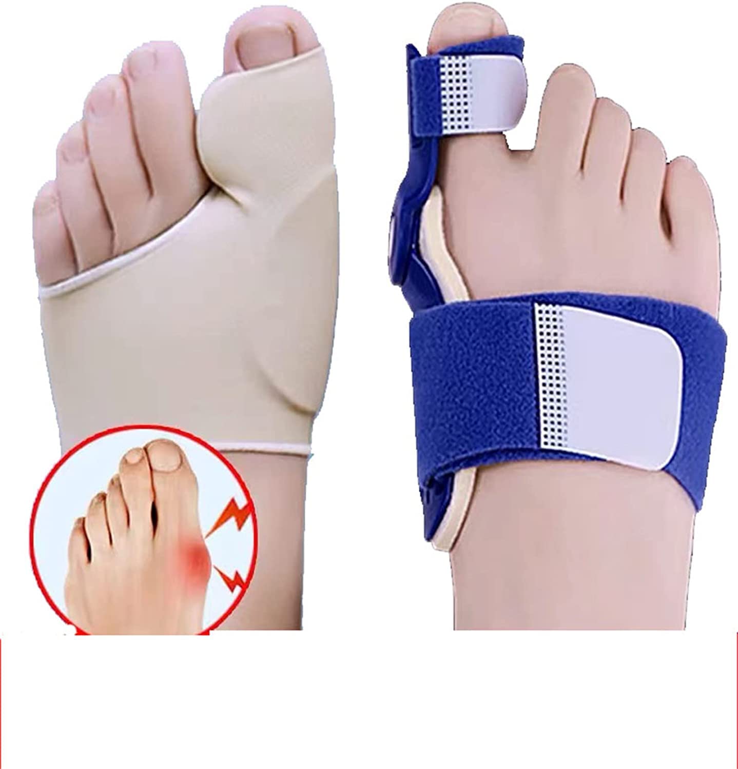 2pcs Bunion Corrector Splint Toe Straightener Brace Hallux Valgus Pain Relief Foot Care Hallux Valgus Corrector Orthopedic Tool Breathable Flexible(