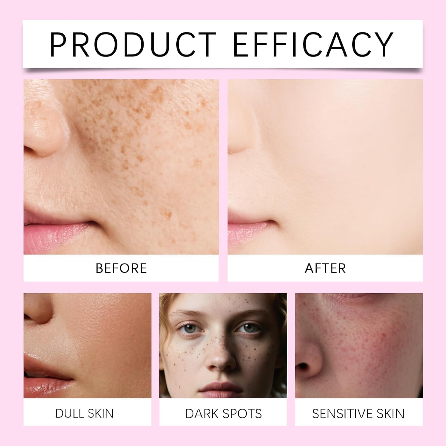 1/2 Jar Arbutin 7% + Tranexamic Acid 4% Cream - Lightweight Brightening Moisturizer to Help Reduce the Look of Dark Spots, Uneven Tone & Dullness with Niacinamide and Glutathione, 50g (2PC, 50G)