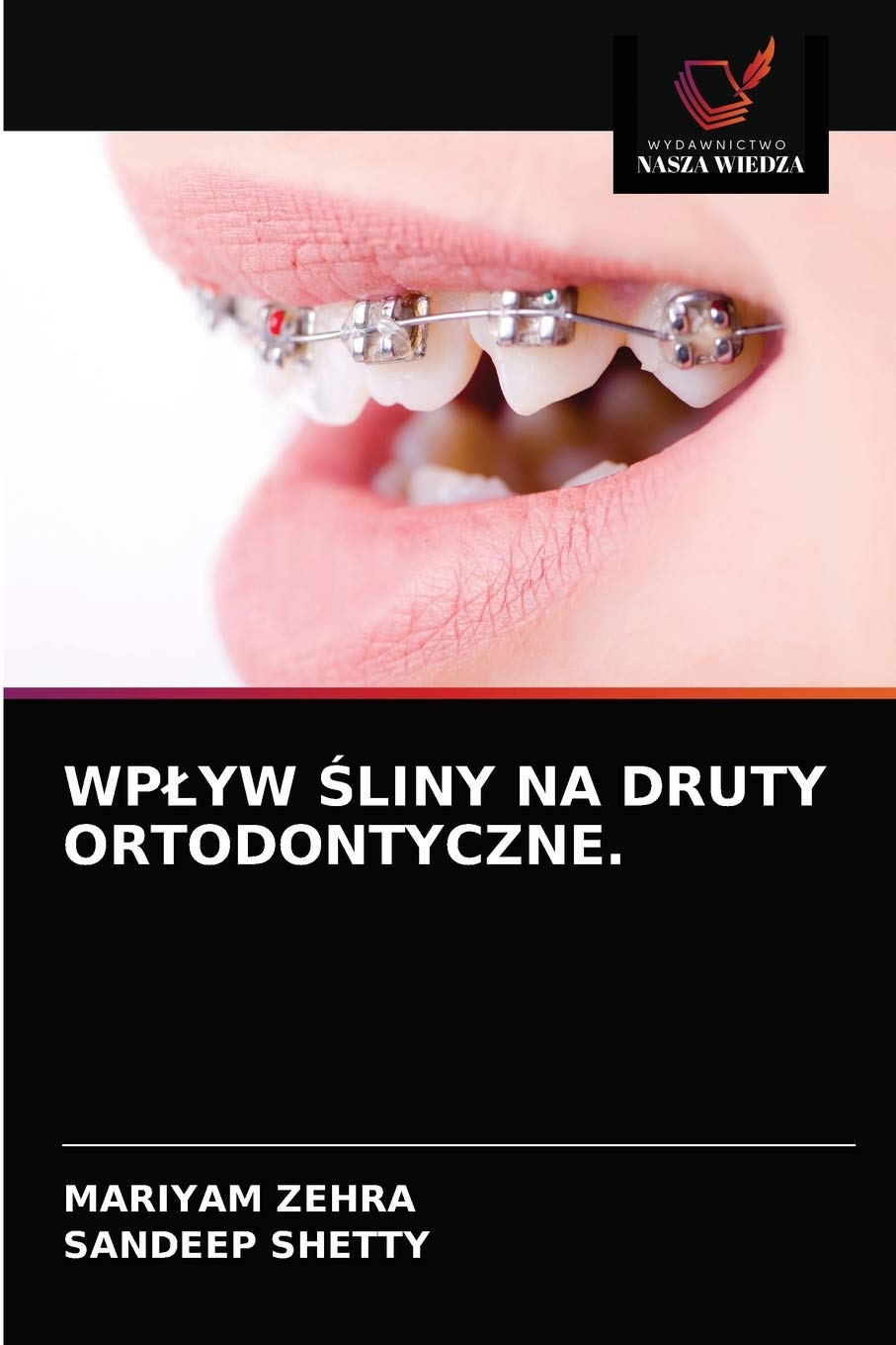 WPŁYW ŚLINY NA DRUTY ORTODONTYCZNE. (Polish Edition)