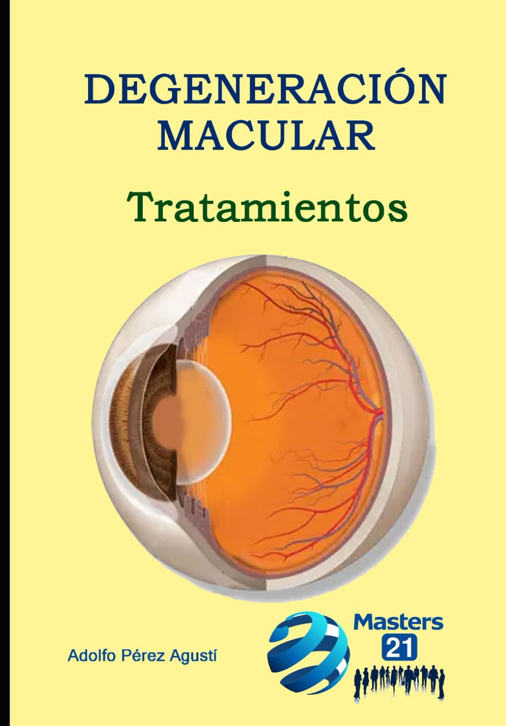 Degeneración Macular: Tratamientos