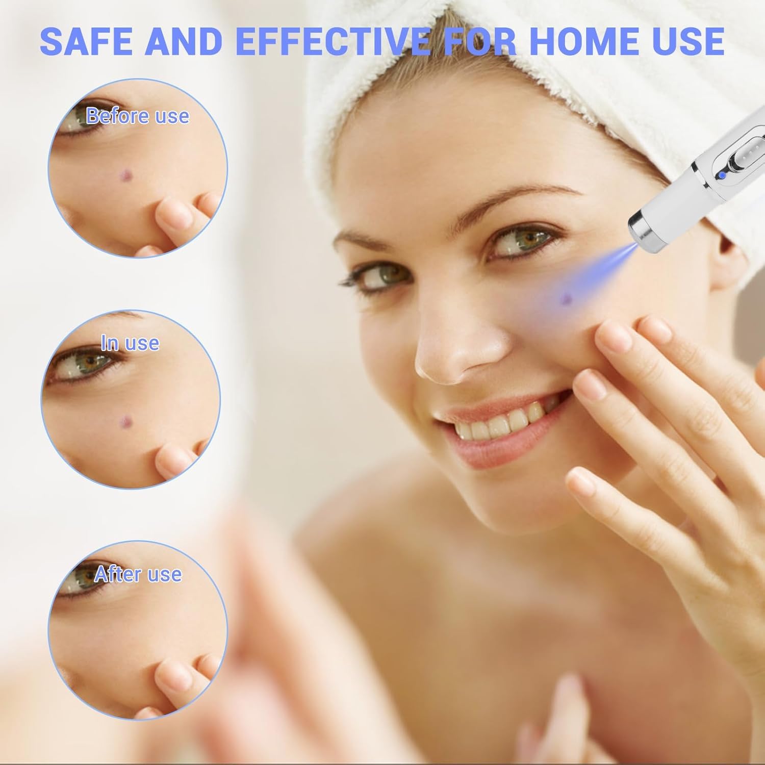 Penna laser non invasiva per la rimozione di lentiggini e verruche, penna laser per la crescita della pelle di viso e corpo, adatta per la rimozione di verruche, acne e nei