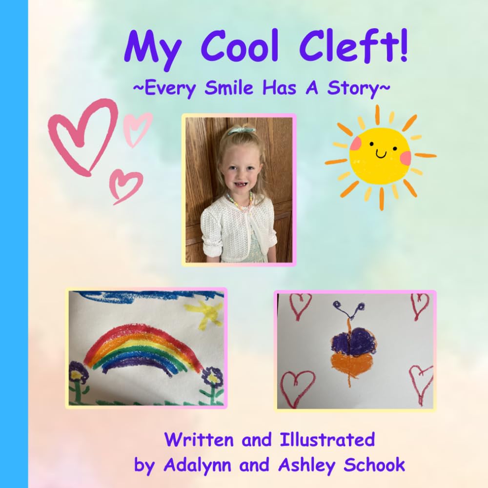 My Cool Cleft!