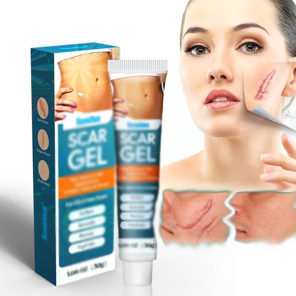 NALACAL Scar Cream Advance Scar Gel for Surgical Scars, Burns, Acene, C-Section, Stretch Marks, Keloids, Scar Removal Cream for Old and New Scars, Suitable for Women Men Face Arm Leg Body (1.06 Oz)