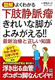 図解 よくわかる下肢静脈瘤 きれいな脚がよみがえる!! 最新治療と正しい知識