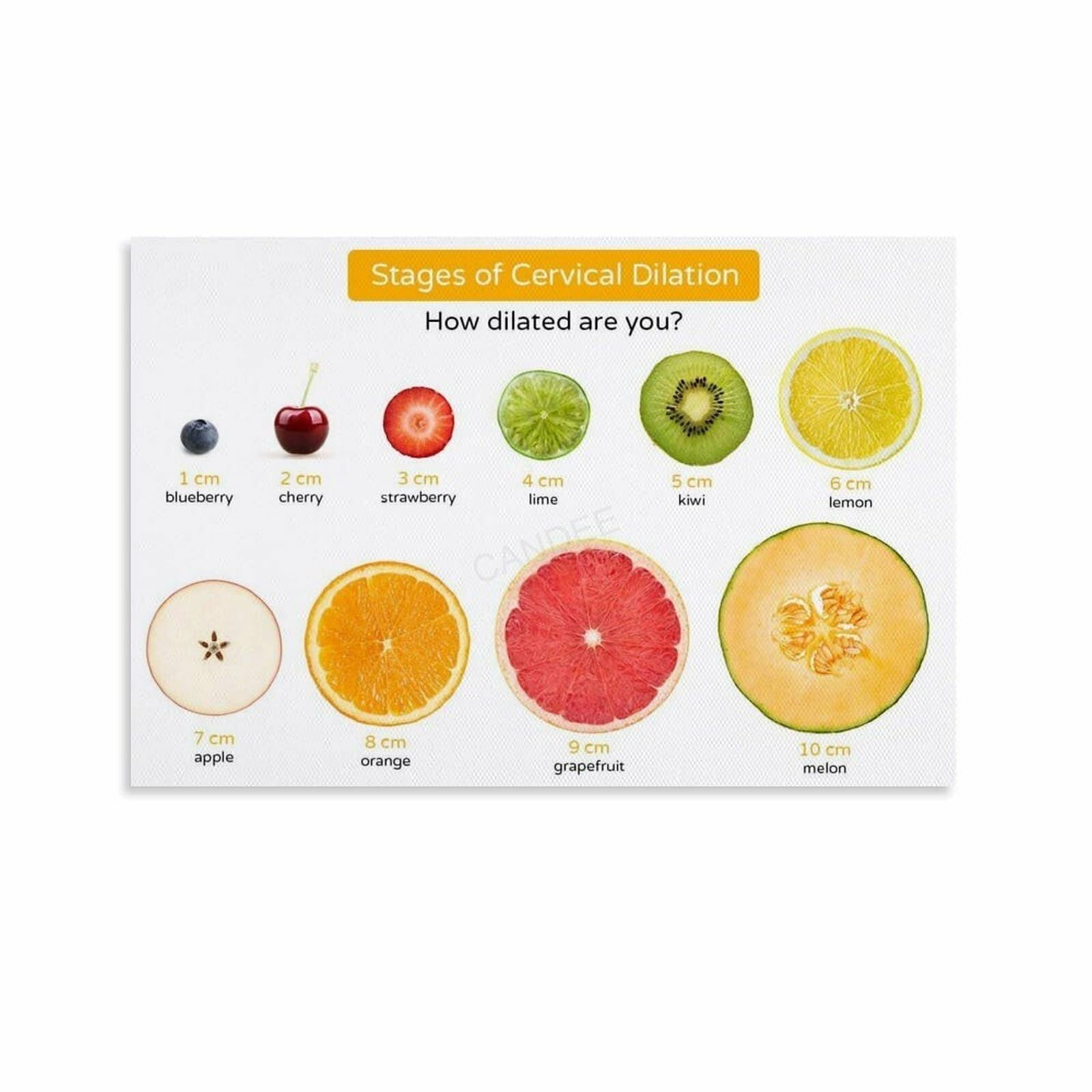 GYQYJPFZM Understanding Labor Progression Poster Cervical Dilation Stages Chart Watercolor Wall-Art for Maternity Ward Childbirth Class(Unframed,16x24inch(40x60cm))