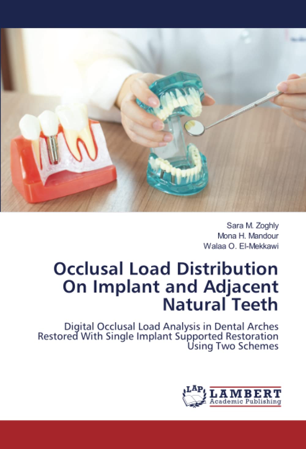 Buy Occlusal Load Distribution On Im and Adjacent Natural Teeth