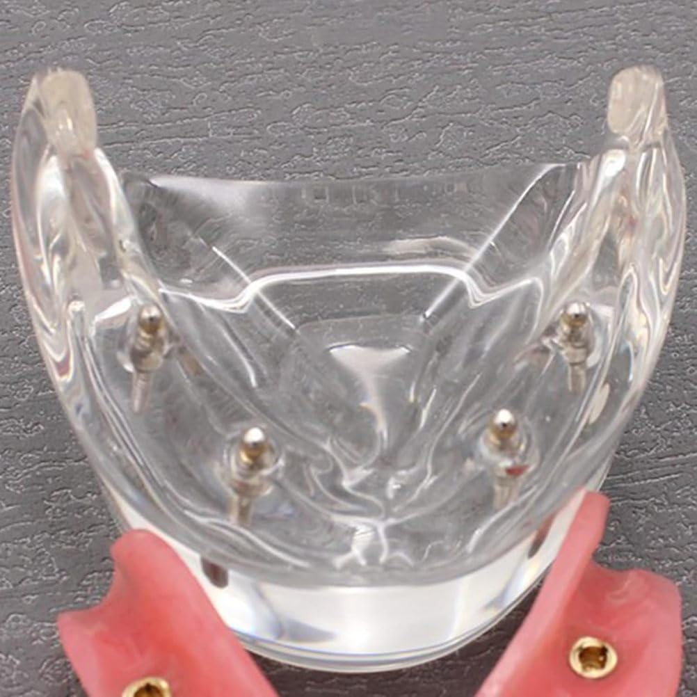Model zębów implantów dentystycznych Wyczyść opóźnienie 4 Implanty górnej górnej bazy szczękowej do studiowania nauczania