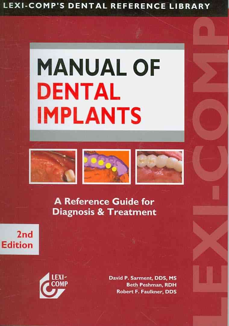 Manual of Dental Implants A Reference Guide for Diagnosis & Treatment
