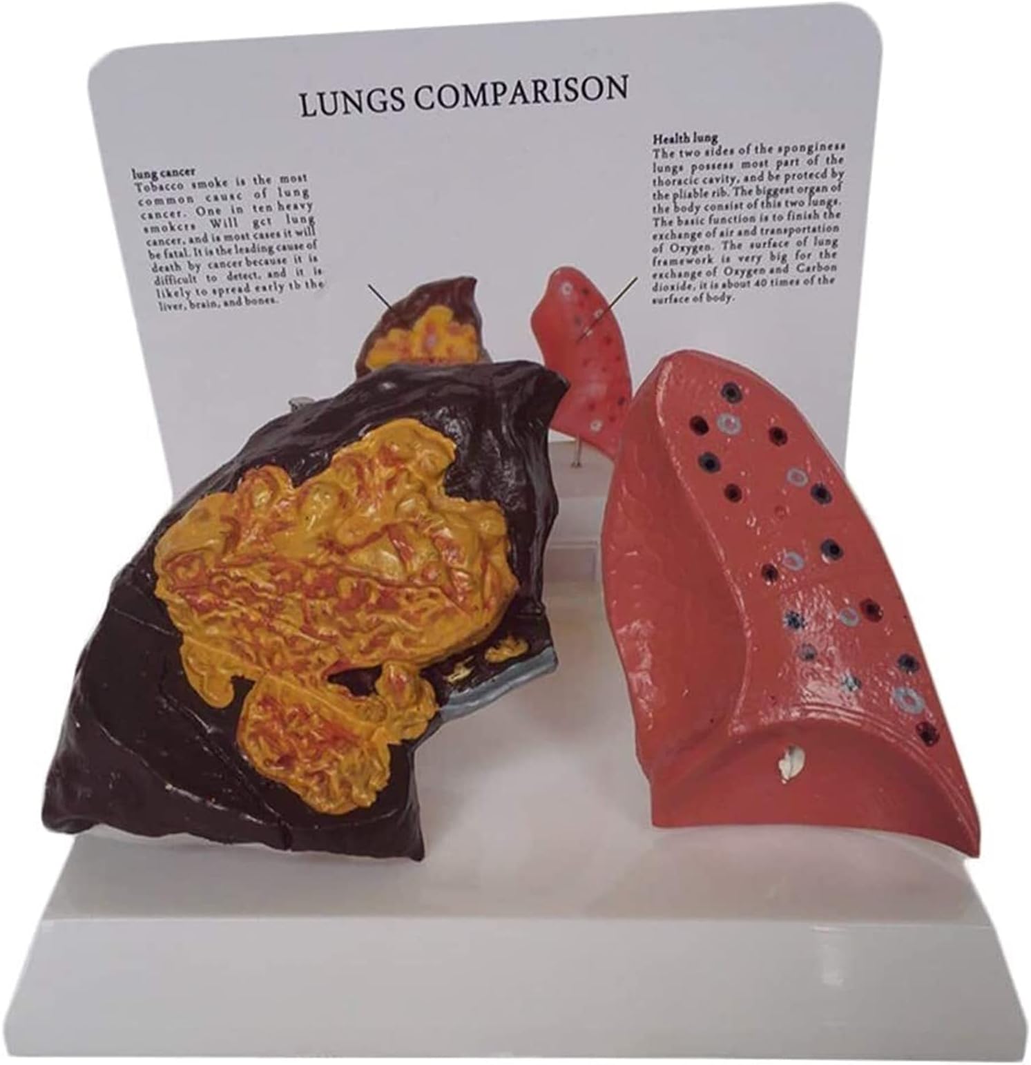 Study Model Lung Anatomy Model Human Respiratory System Model Smoking Lung And Normal Lung Comparison Teaching Models