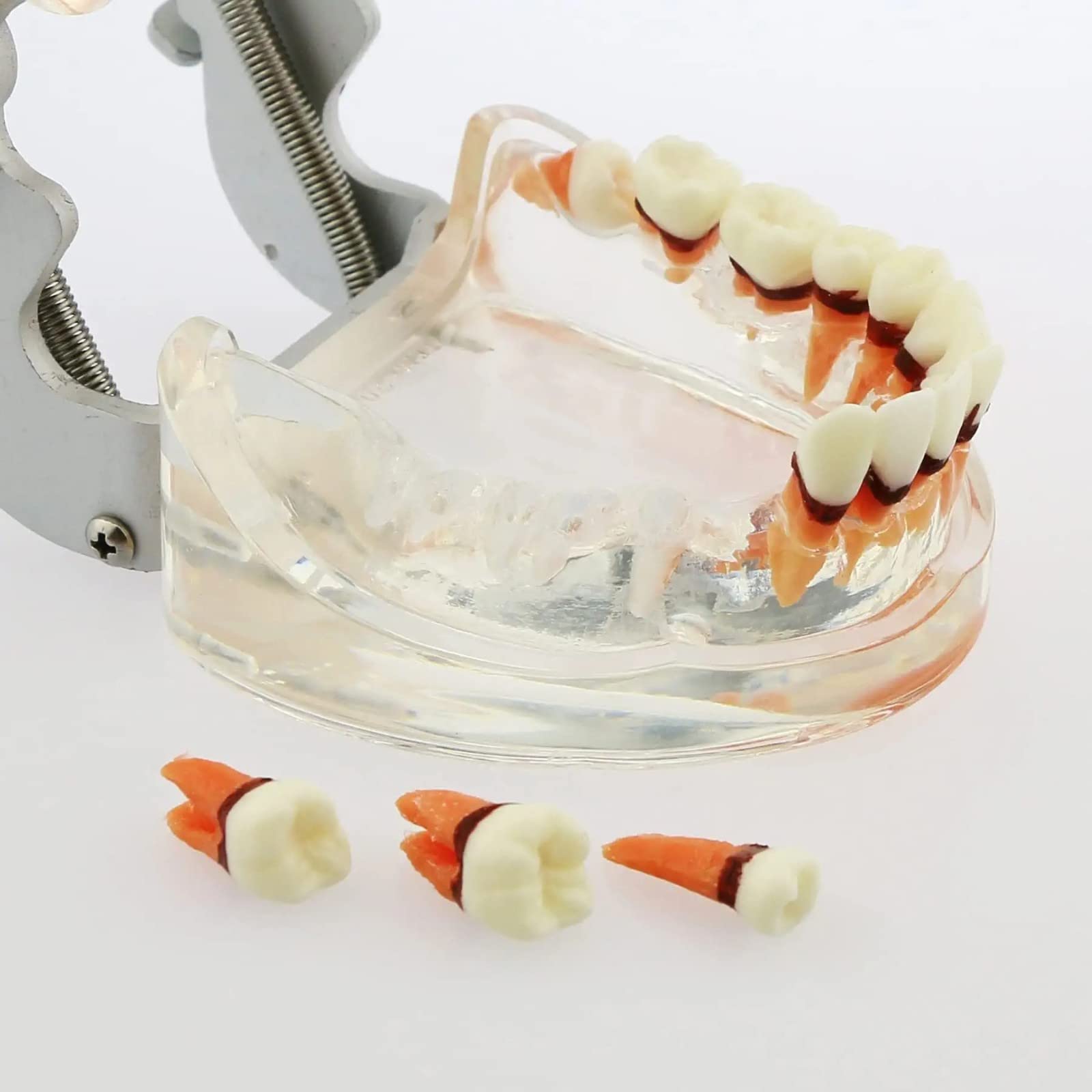 Modello Denti per Malattia Parodontale per Studio Odontoiatrico, Typodont con Gomme Morbide per Insegnamento e Formazione in Odontoiatria, Strumento Educativo Anatomico