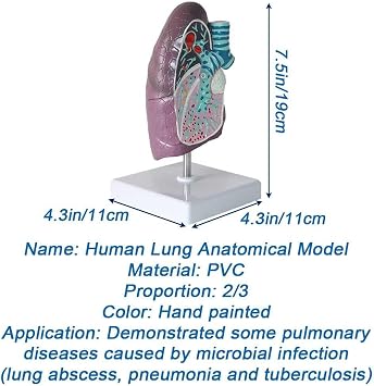YANHAO Lung Cancer Model Pathology Lung Model 3D Human Lung Anatomical Model wirh Clear Texture & Accurate Anatomy Structure for Teaching Models Doctor-Patient Communication