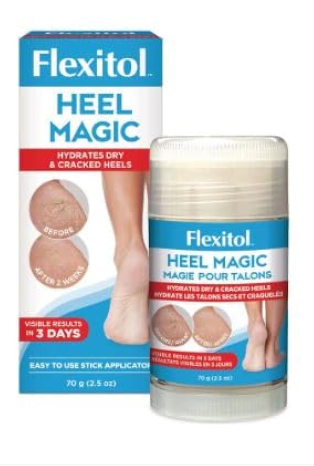 HEEL MAGIC FLEXITOL 70 GM