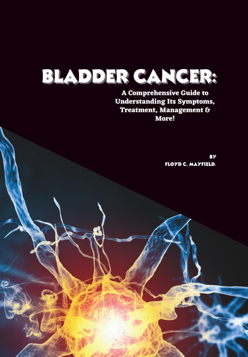Bladder Cancer: A Comprehensive Guide to Understanding Its Symptoms, Treatment, Management & More! (Cancer Decoded)