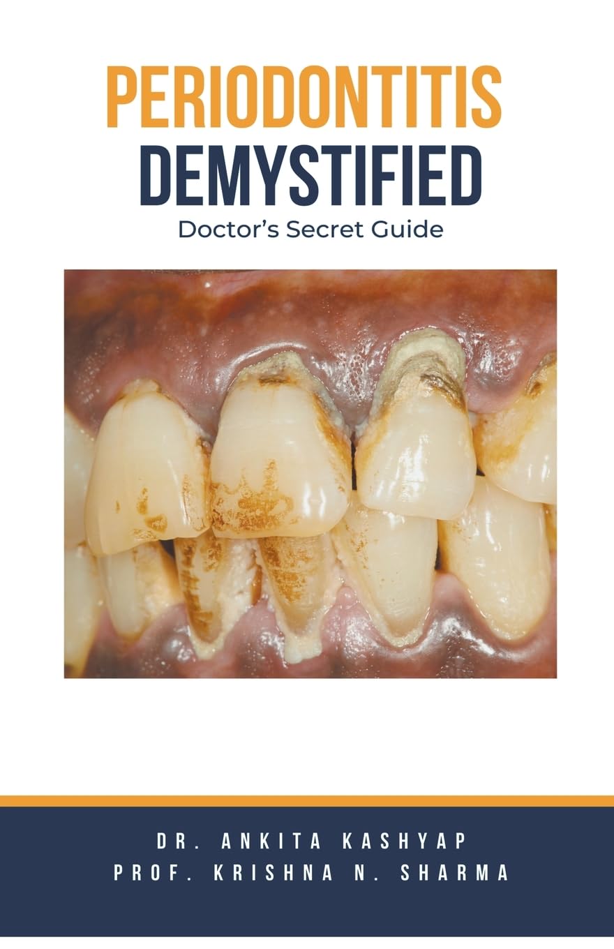 Periodontitis Demystified: Doctor's Secret Guide