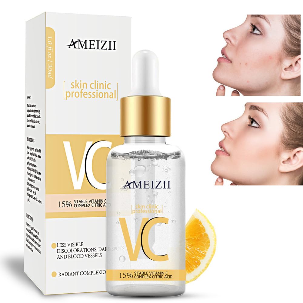 Vitamin C Whiteinig Serum - Gives Radiant Complexion, Reduce Dark Dpots and Blemishes, Anti-Oxidant, Deep Cleansing, Exfoliation, Moisturising for Youthful and Glowing Skin