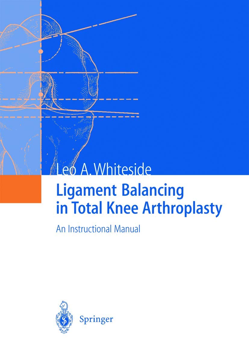 Ligament Balancing in Total Knee Arthroplasty: An Instructional Manual