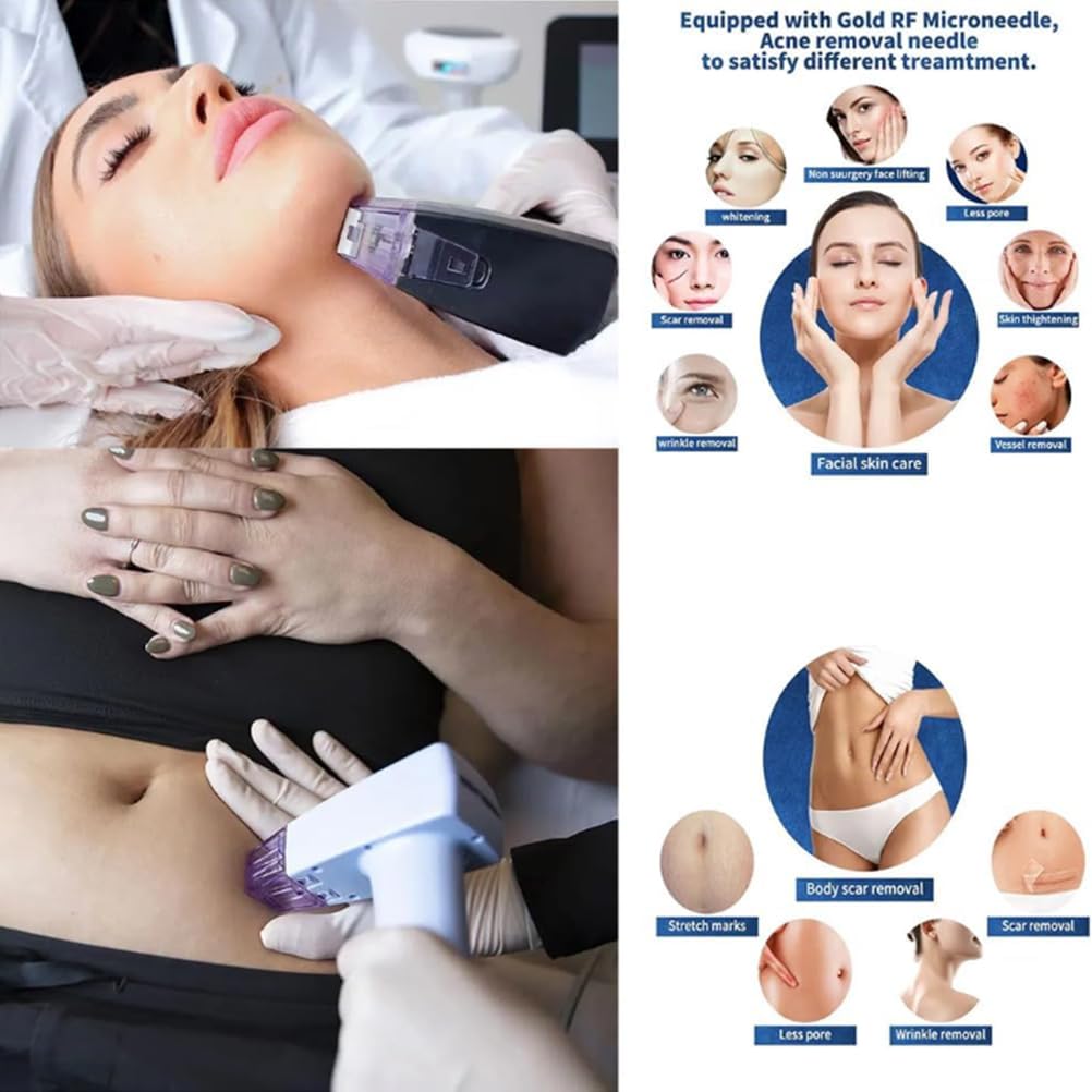BCBKD Dispositivo Antienvejecimiento Portátil Morpheus 8 – Radiofrecuencia Fraccionada con Microagujas, Lifting Facial En Casa, Reducción De Arrugas, Poros Y Flacidez, Rejuvenecimiento De La Piel