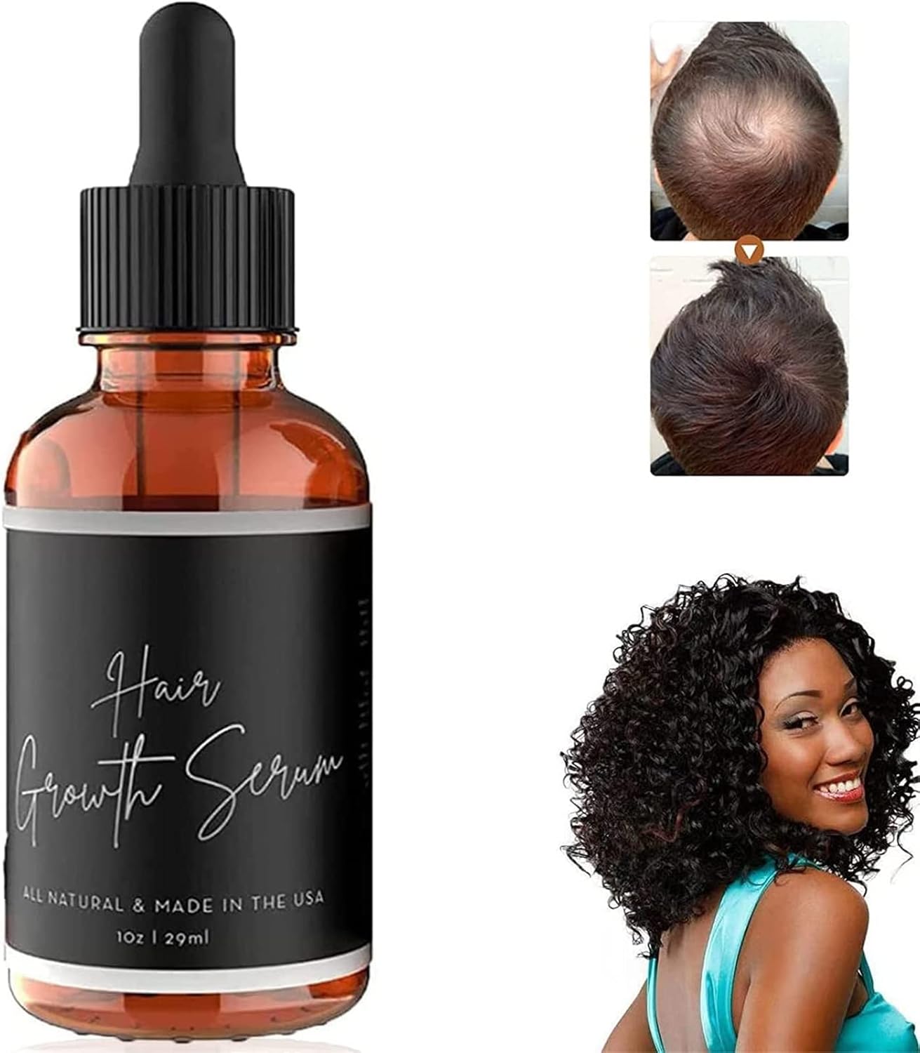 Allurium Hair Growth Serum For Black Women, 2023 New Allurium Hair