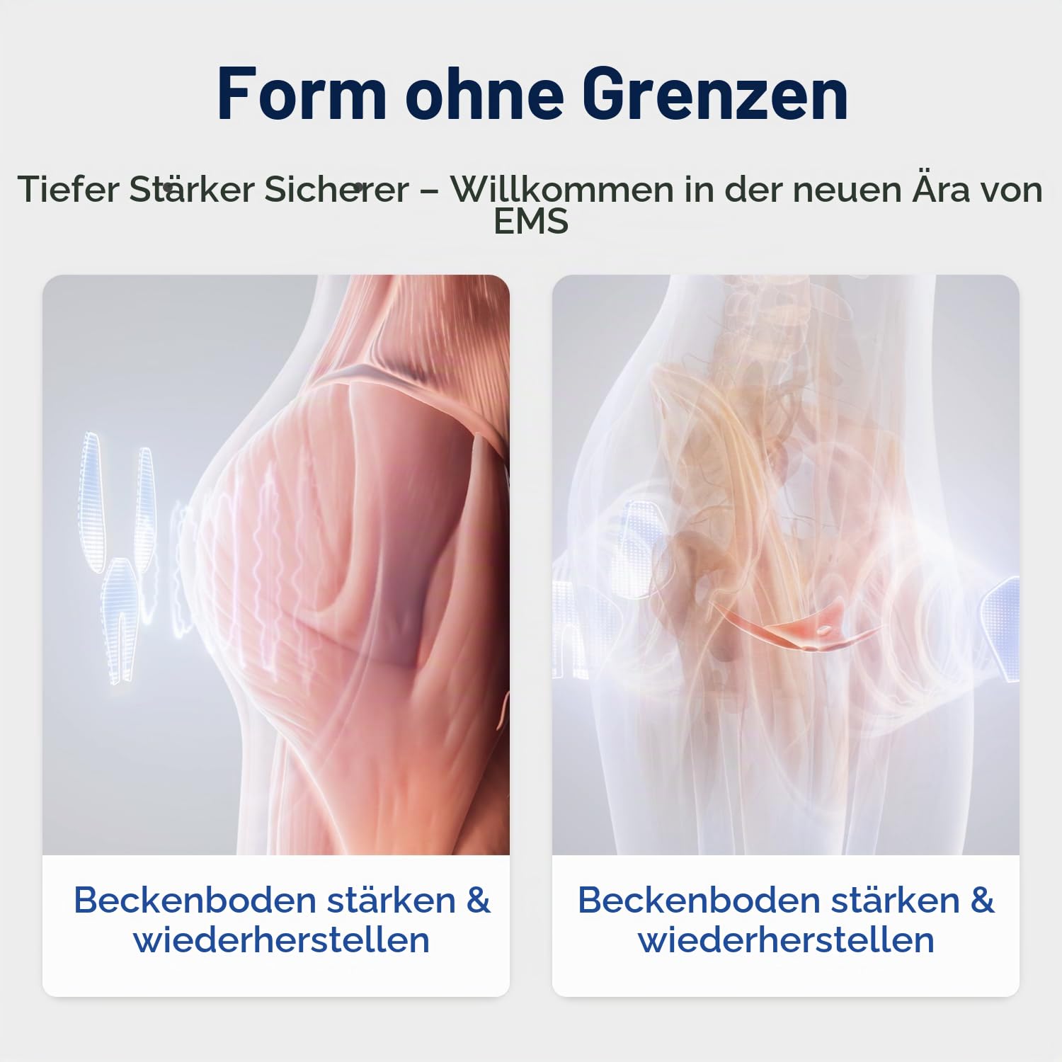 MEGELIN EMS-Toning-Shorts, Tiefenmuskelaktivierung zur Wiederherstellung der Hüft- und Beckenfunktion für Frauen zu Hause, sichtbare Ergebnisse in 2–4 Wochen, schwarz
