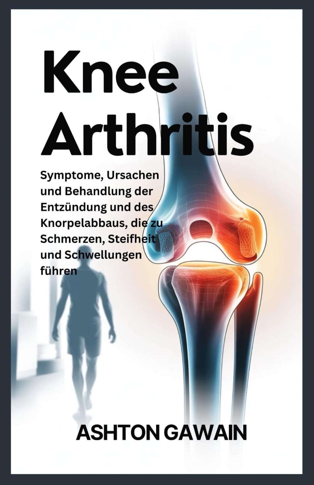 Knee Arthritis: Symptome, Ursachen und Behandlung der Entzündung und des Knorpelabbaus, die zu Schmerzen, Steifheit und Schwellungen führen