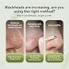 Blackhead Remover Mask 60 pcs,Remove Black Heads Face Black Head Remover Strips,Nose Plants Pore Cleanser Purifying Face Mask for All Skin Types(1.06oz/30g)