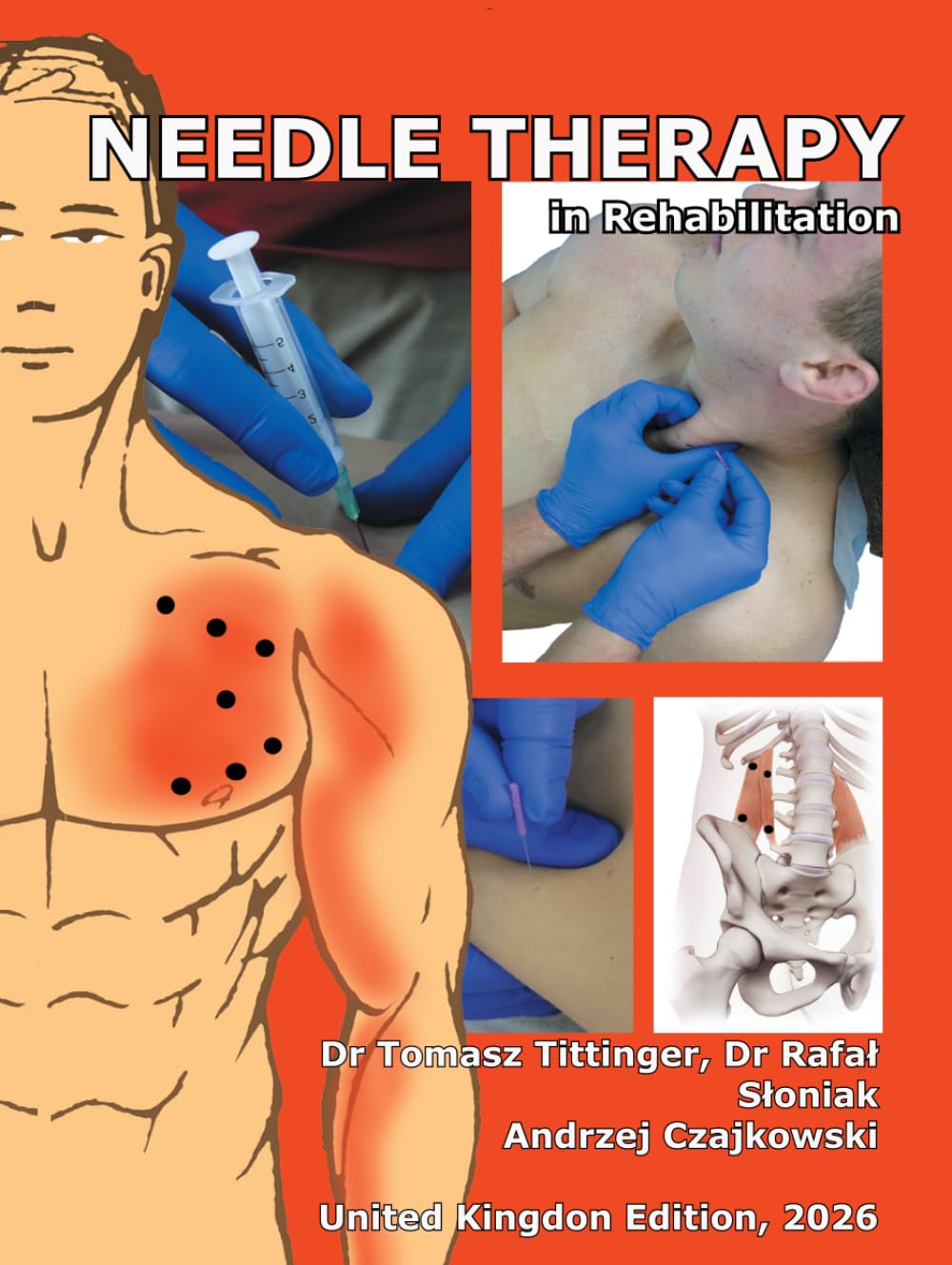 Needle Therapy in Rehabilitation