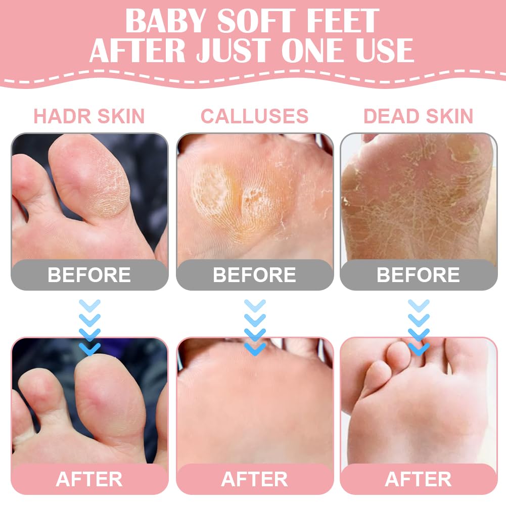 Maschera Piedi Idratante, 4 Paia Maschera Piedi ad Azione Idratante e Rigenerante, Calzini Idratanti per Riparazioni Cutanee Secche Invecchiamento Cracked Heels, per Piedi Lisci e Morbidi