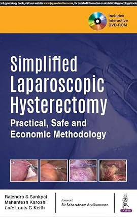 SIMPLIFIED LAPAROSCOPIC HYSTERECTOMY PRACTICAL, SAFE AND ECONOMIC METHODOLOGY WITH DVD-ROM