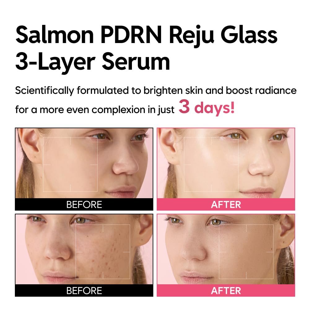 Salmon PDRN Reju Glass 3-Layer Serum, Radiance & Firming Facial Serum with 1% PDRN, Niacinamide, Collagen, Hyaluronic Acid, 30g (1.06 fl oz) - Image 3
