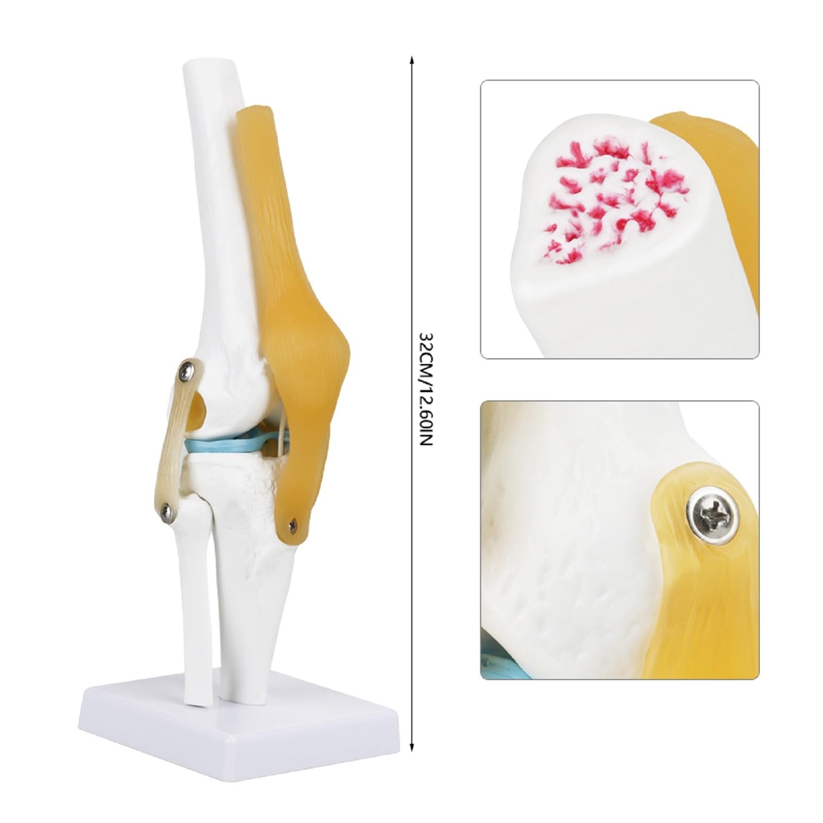Anatomie Modell Kniegelenk, Skelett Lebensgroß Kniegelenkmodell Menschliches mit Ligamen, 3D Orthopädische Knie Modell für Medizinisches Lehren, Klinik-Demonstration, Lern- und Bildungsanzeigetools