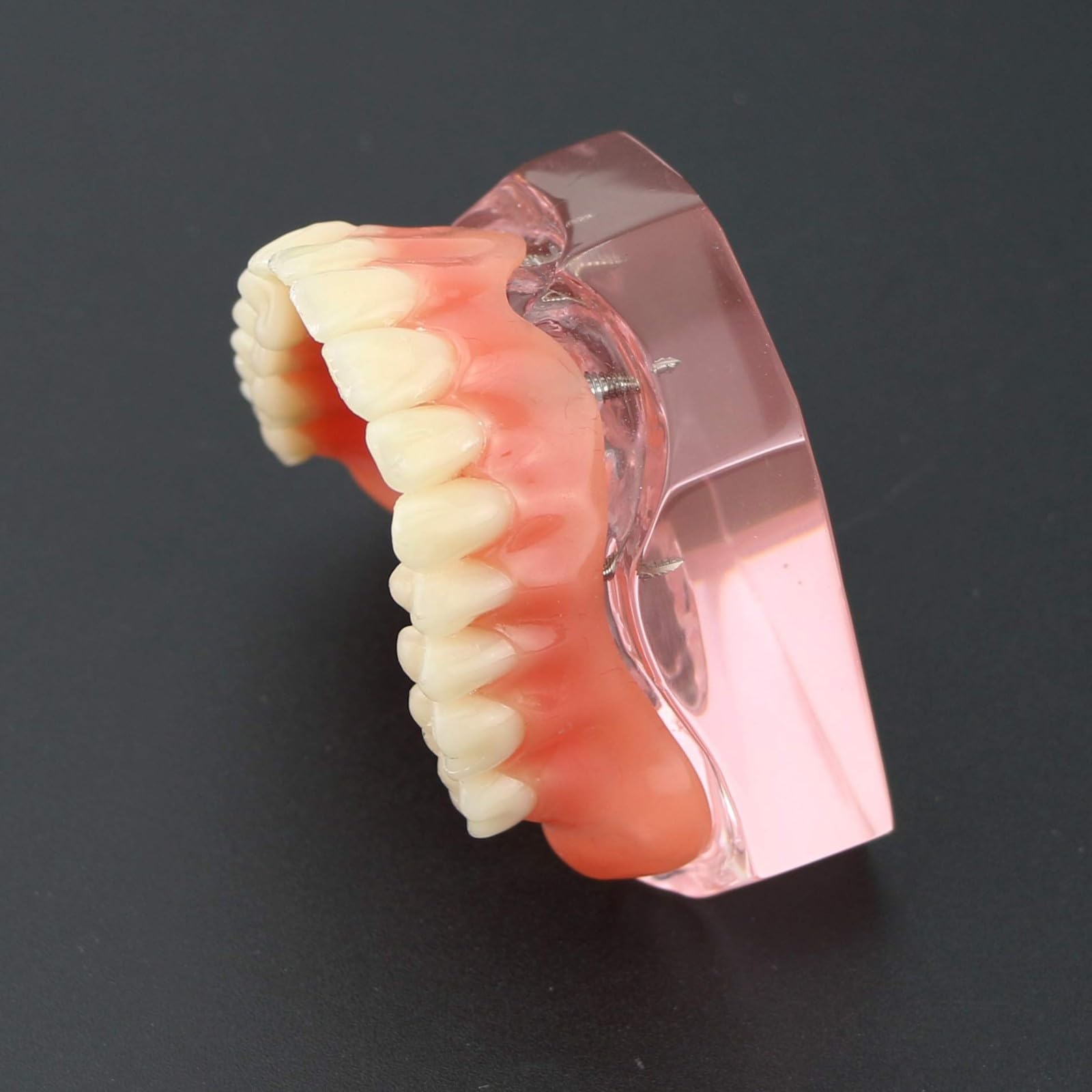 Modelo de dientes para implantes dentales tipodonto, rosa transparente, restauración de implantes dentales tipodonto, sobredentadura, 4 implantes, superior, demostración para estudio y enseñanza.