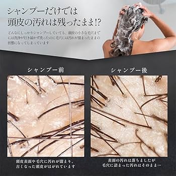 頭皮用　ウォーター　ピーラー　WATER PEELER for SCALP 新品 頭皮専用ウォーターピーラー 頭皮の悩みを一掃！健康な毛髪は