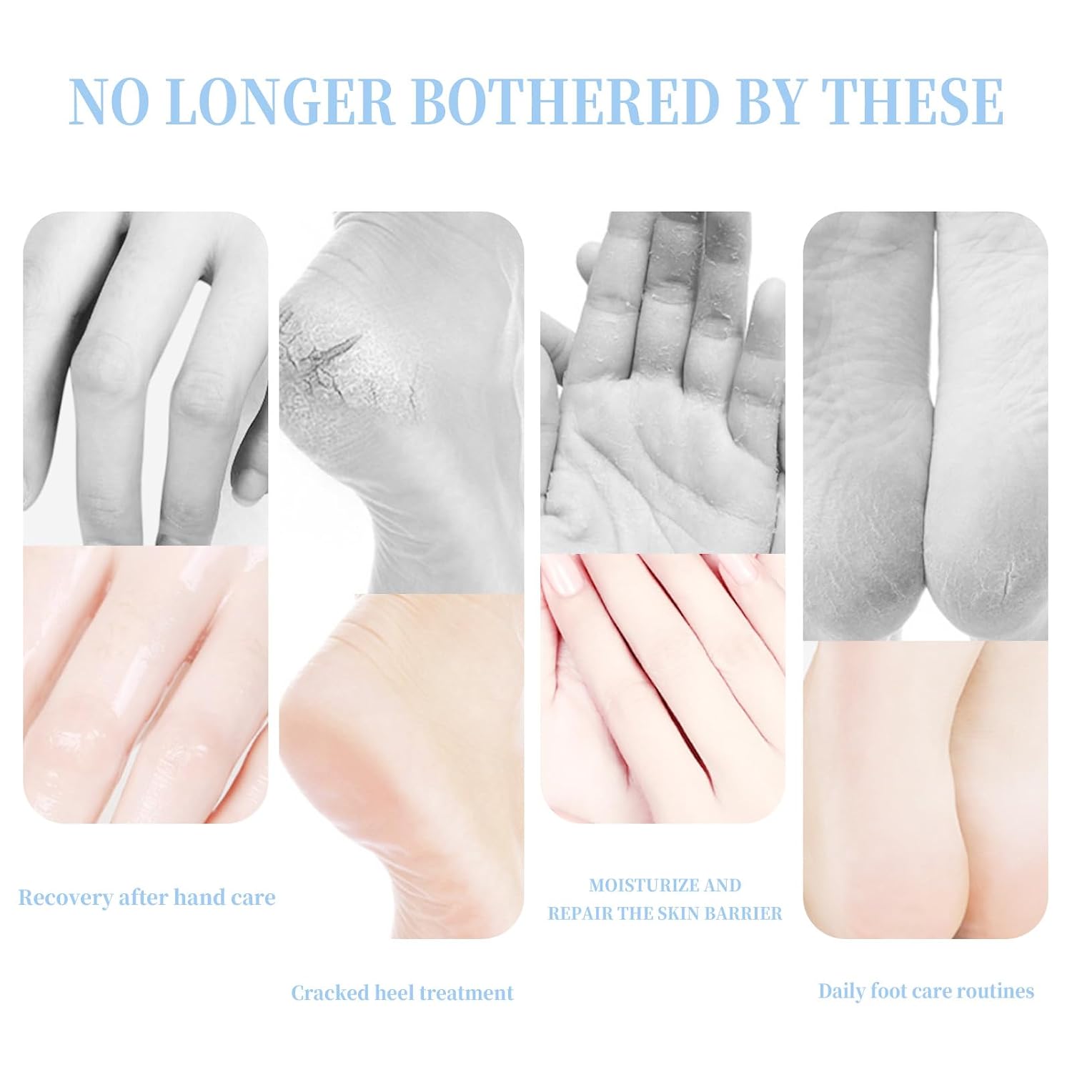 Crack Feet Prevention Stick Strength Moisturizer Foot Lotion Stick for Cracked Heels Refreshing Hydrates Callus Skin Softene for Dry Cracked Feet Knees Elbows Hands (2pcs blue ＆ peach)