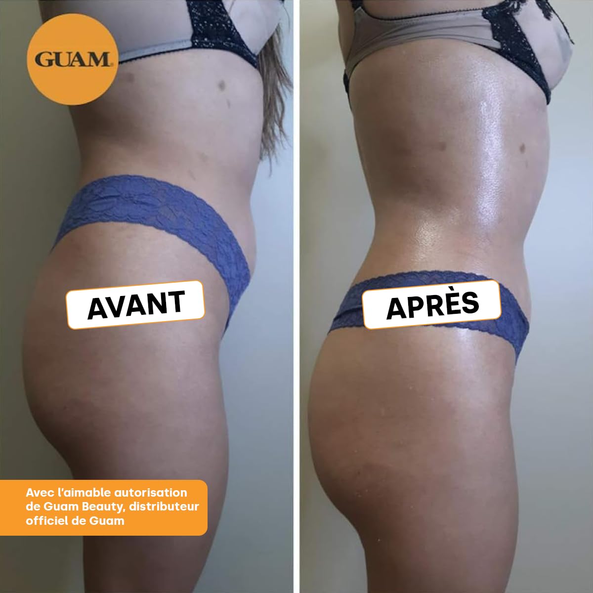 GUAM Anti-Cellulite Boue d’Algues - 1 kg Traitement Intensif pour Cellulite Rebelle & Peau d’orange - Masque Corporel Chauffant Jambes & Cuisses - Raffermissant, Drainant, Active la Circulation