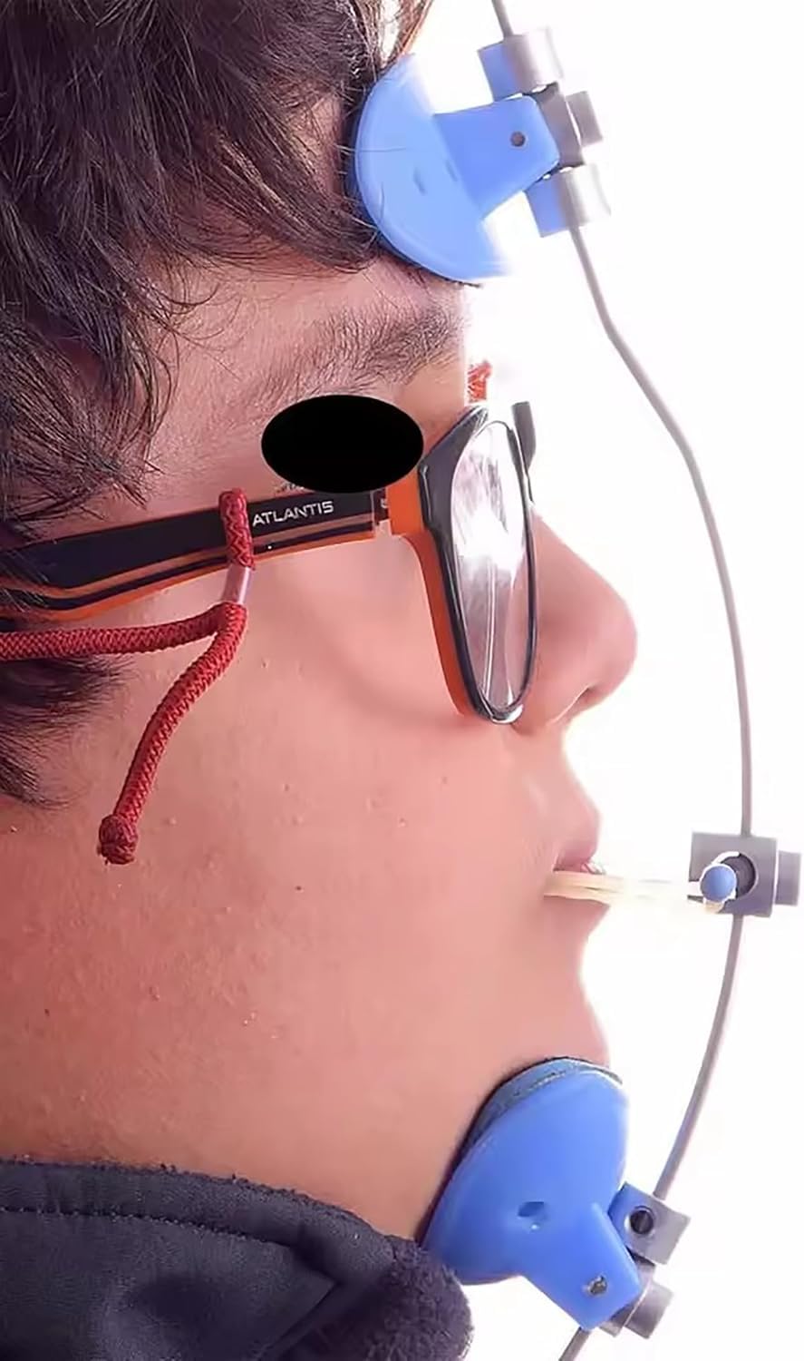 Casque Orthodontique, Appareil De Traction Externe De La Mâchoire Entièrement Réglable, Arc Facial, Appareil Dentaire À Traction Inversée, Casque Avec Bouton De Sécurité