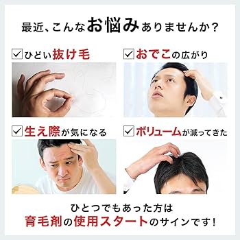 Amazon | スーパーサイヤ 育毛剤 男性用 発毛促進 抜け毛 薄毛