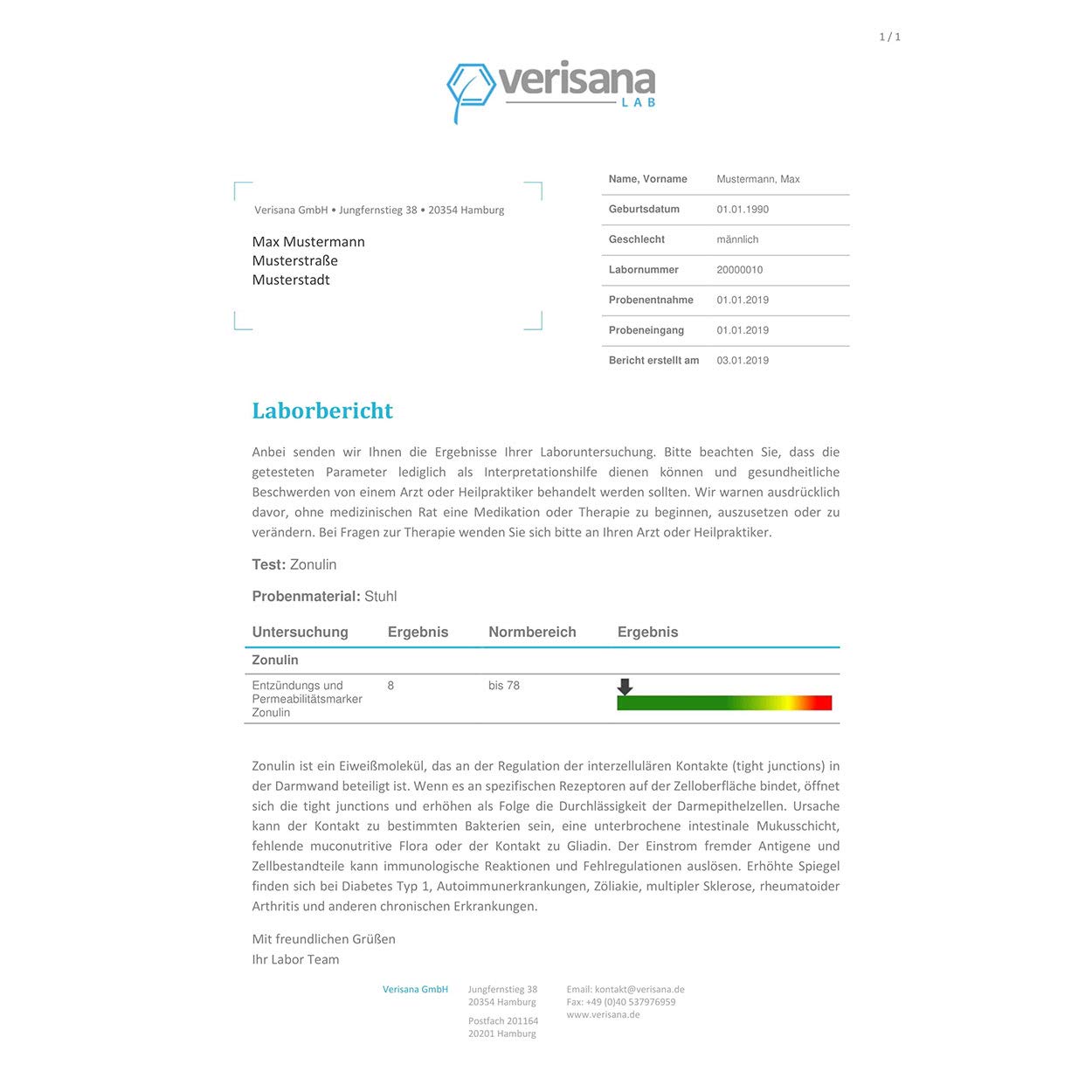 Zonulin Test – Stuhltest auf Leaky Gut Syndrom – Durchlässiger Darm Test – Verisana Darmgesundheit