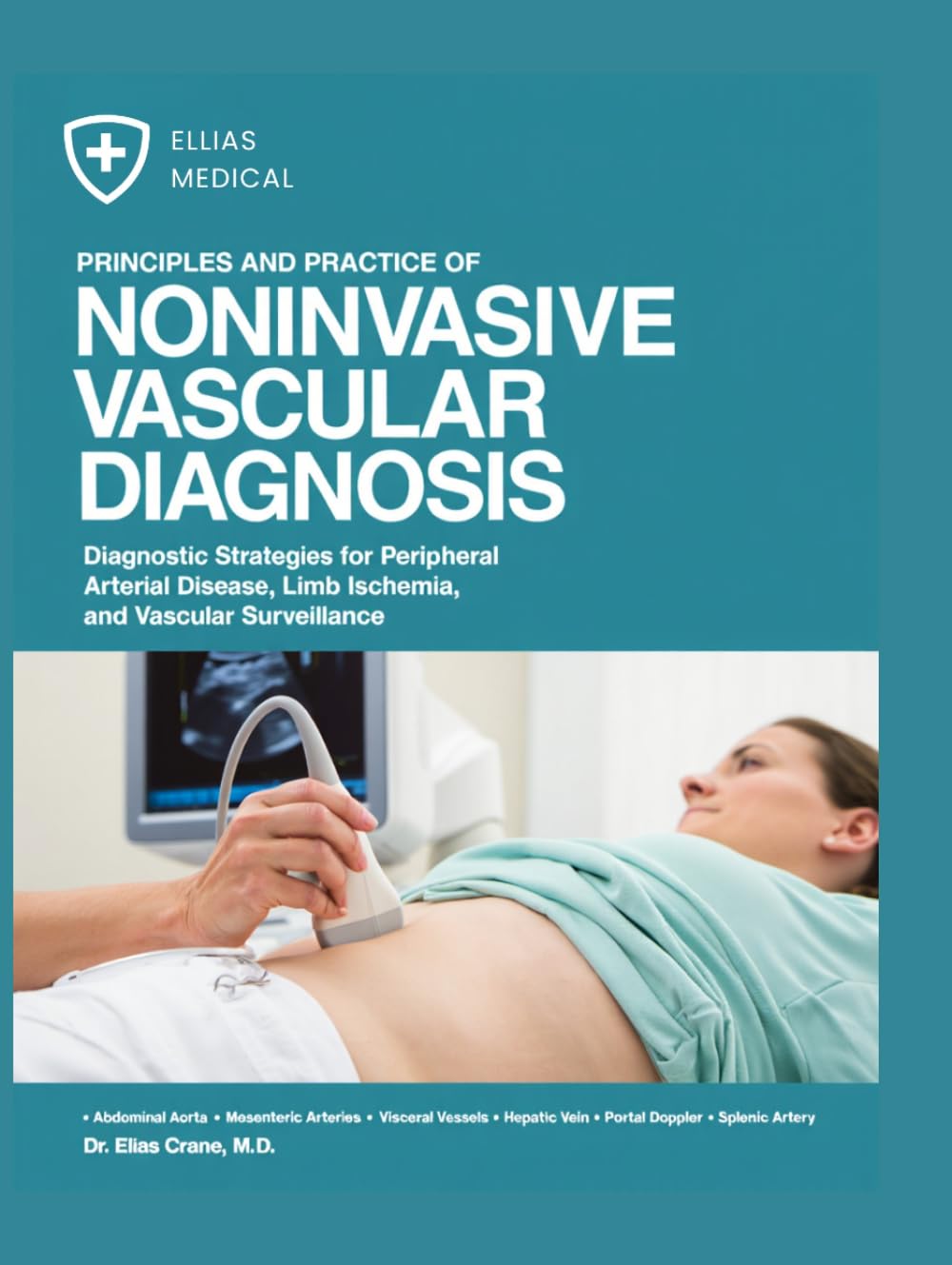 Principles and Practice of Noninvasive Vascular Diagnosis: Diagnostic Strategies for Peripheral Arterial Disease, Limb Ischemia, and Vascular Surveillance