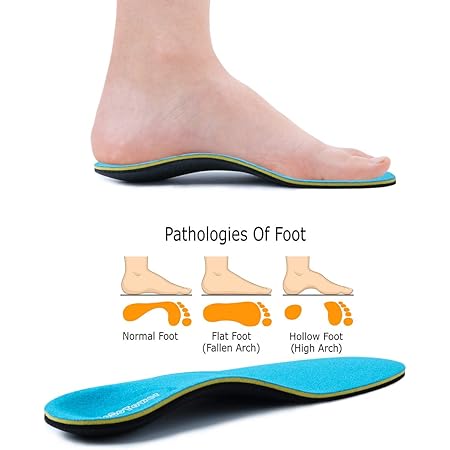 rigid arch support