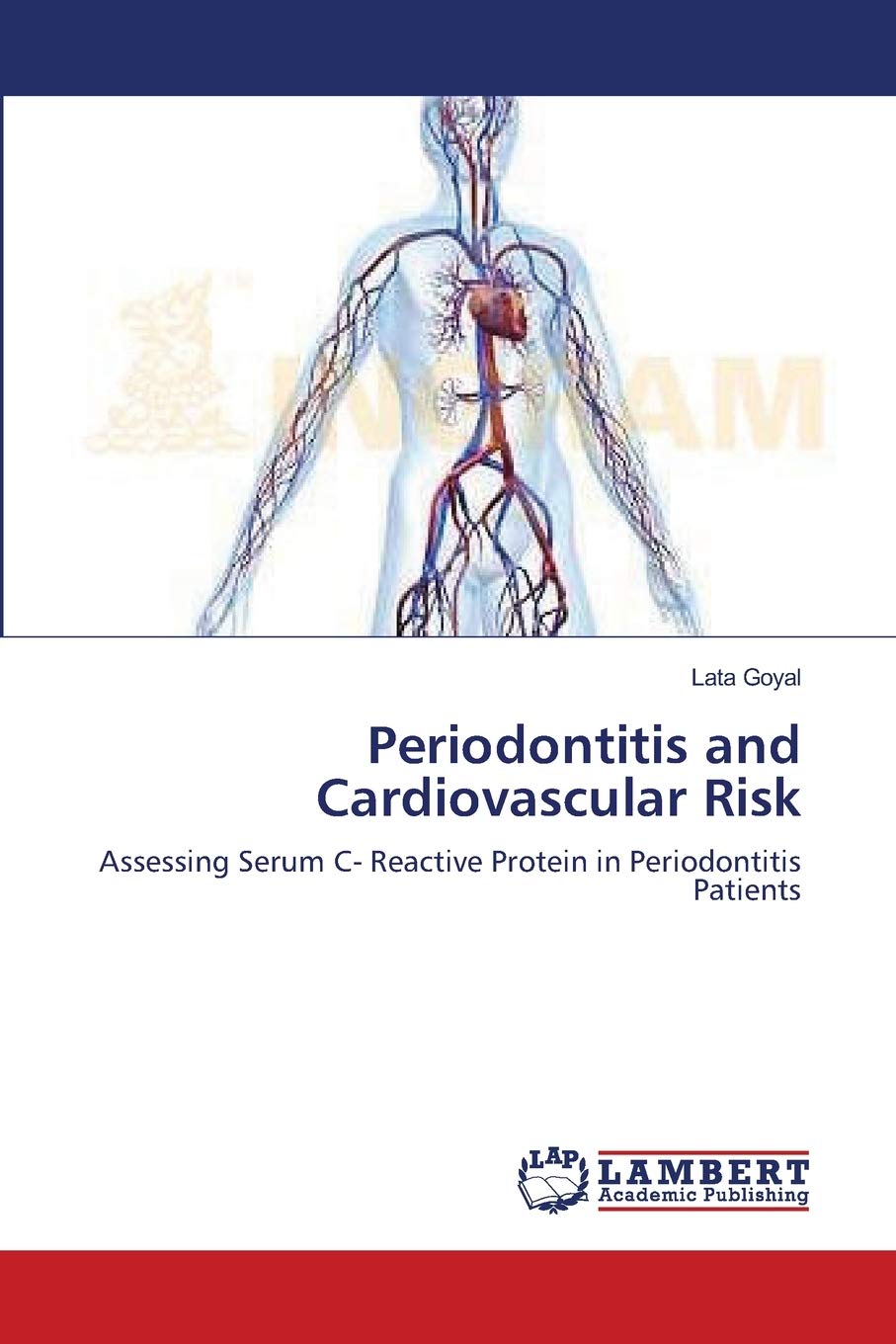 Periodontitis and Cardiovascular Risk: Assessing Serum C- Reactive Protein in Periodontitis Patients